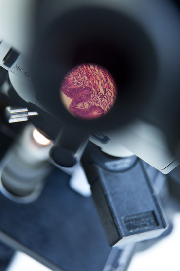 Blick durch das Okular eines Mikroskopes.